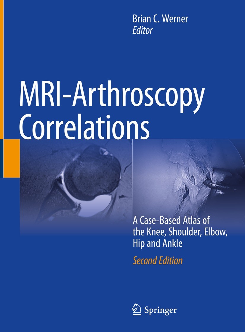Titlebook: MRI-Arthroscopy Correlations; A Case-Based Atlas o Brian C. Werner Book 2022Latest edition The Editor(s) (if applicable) and The Author(s), Titlebook: MRI-Arthroscopy Correlations; A Case-Based Atlas o Brian C. Werner Book 2022Latest edition The Editor(s) (if applicable) and The Author(s),