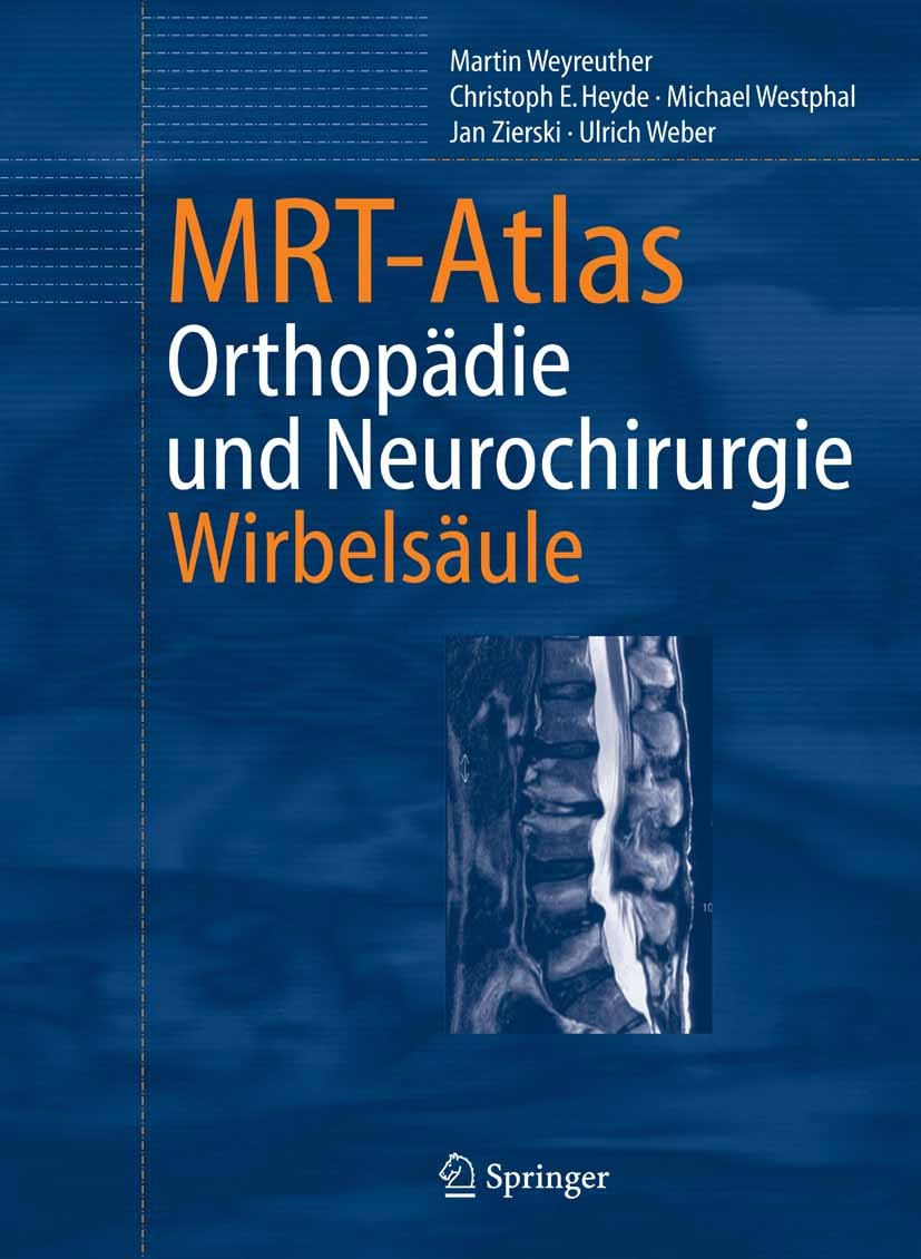 Titlebook: MRT-Atlas; Orthopädie und Neuro Martin Weyreuther,Christoph E. Heyde,Ulrich Weber Book 2006 Springer-Verlag Berlin Heidelberg 2006 Arthrose Titlebook: MRT-Atlas; Orthopädie und Neuro Martin Weyreuther,Christoph E. Heyde,Ulrich Weber Book 2006 Springer-Verlag Berlin Heidelberg 2006 Arthrose
