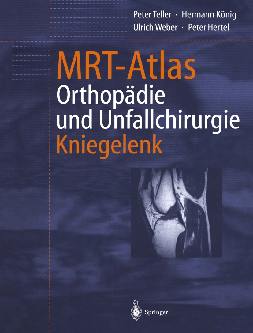 Titlebook: MRT-Atlas Orthopädie und Unfallchirurgie; Kniegelenk Peter Teller,Hermann König,Peter Hertel Book 2002 Springer-Verlag Berlin Heidelberg 20 Titlebook: MRT-Atlas Orthopädie und Unfallchirurgie; Kniegelenk Peter Teller,Hermann König,Peter Hertel Book 2002 Springer-Verlag Berlin Heidelberg 20