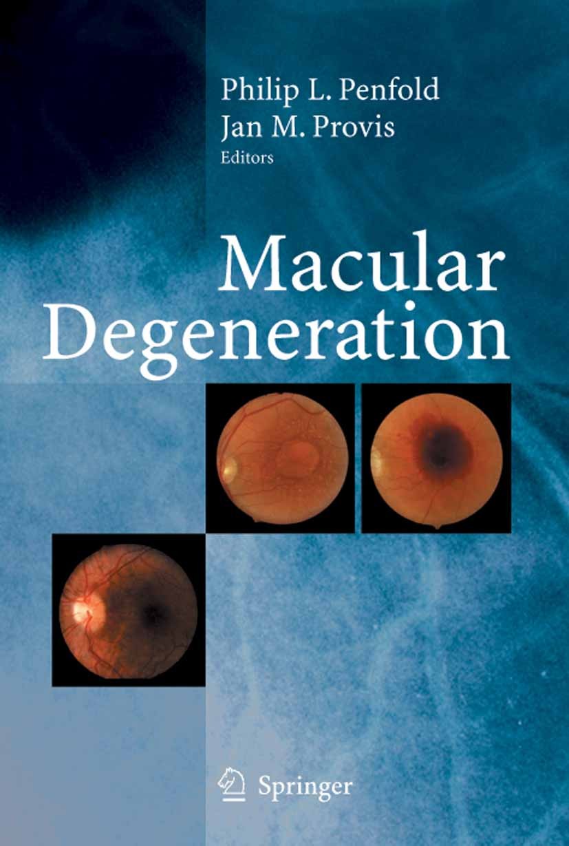 Titlebook: Macular Degeneration; Philip L. Penfold (Chief Scientist),Jan M. Provis Book 2005 Springer-Verlag Berlin Heidelberg 2005 AMD.Histopatholog Titlebook: Macular Degeneration; Philip L. Penfold (Chief Scientist),Jan M. Provis Book 2005 Springer-Verlag Berlin Heidelberg 2005 AMD.Histopatholog
