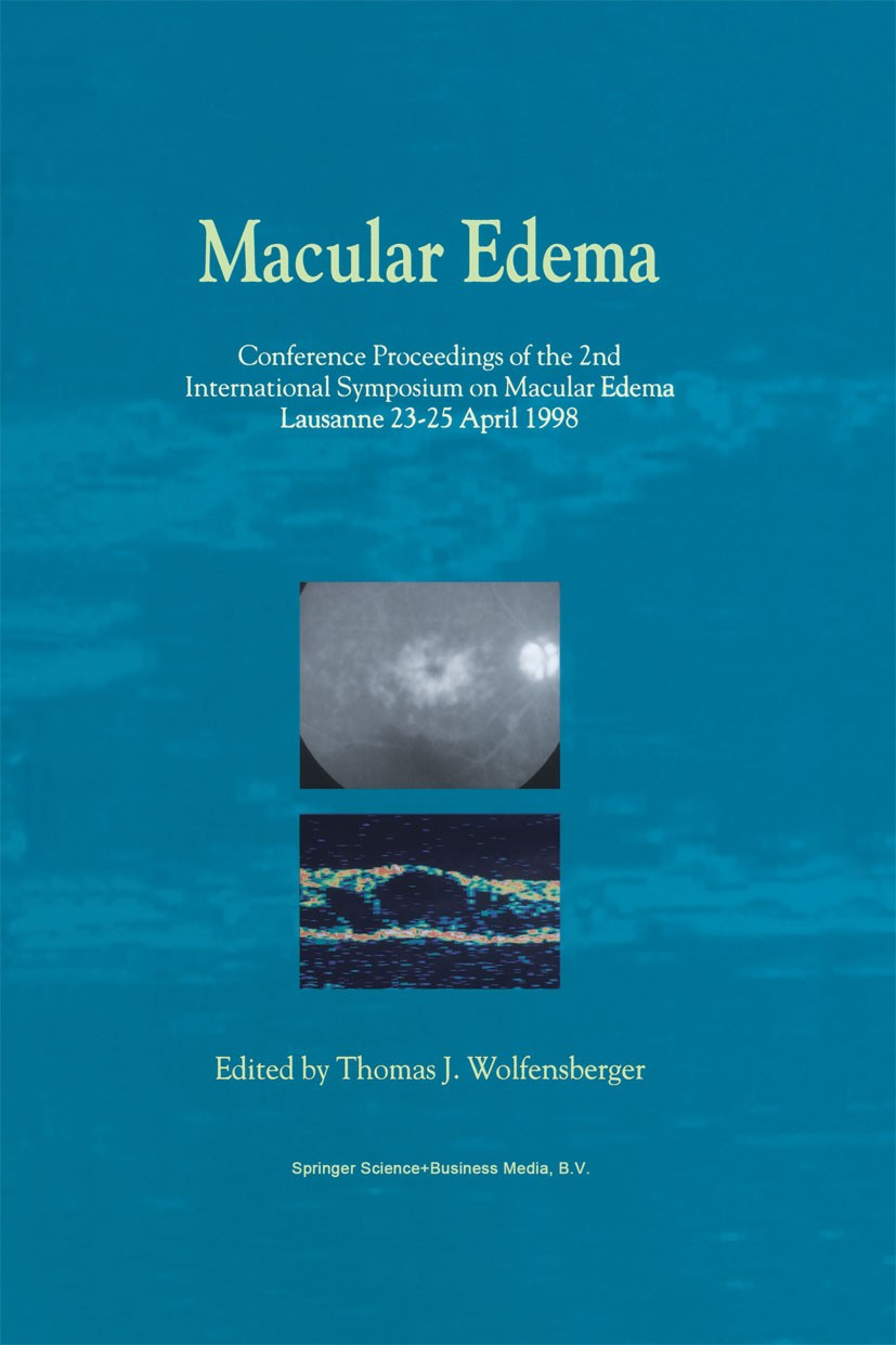 Titlebook: Macular Edema; Conference Proceedin Thomas J. Wolfensberger Conference proceedings 2000 Springer Science+Business Media Dordrecht 2000 dise Titlebook: Macular Edema; Conference Proceedin Thomas J. Wolfensberger Conference proceedings 2000 Springer Science+Business Media Dordrecht 2000 dise