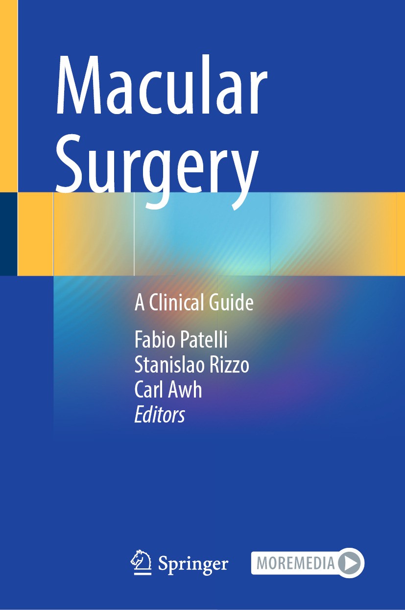Titlebook: Macular Surgery; A Clinical Guide Fabio Patelli,Stanislao Rizzo,Carl Awh Book 2024 The Editor(s) (if applicable) and The Author(s), under e Titlebook: Macular Surgery; A Clinical Guide Fabio Patelli,Stanislao Rizzo,Carl Awh Book 2024 The Editor(s) (if applicable) and The Author(s), under e