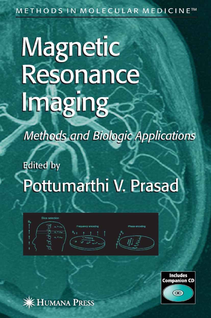 Titlebook: Magnetic Resonance Imaging; Methods and Biologic Pottumarthi V. Prasad Book 2006 Humana Press 2006 Tumor.brain.functional magnetic resonanc Titlebook: Magnetic Resonance Imaging; Methods and Biologic Pottumarthi V. Prasad Book 2006 Humana Press 2006 Tumor.brain.functional magnetic resonanc