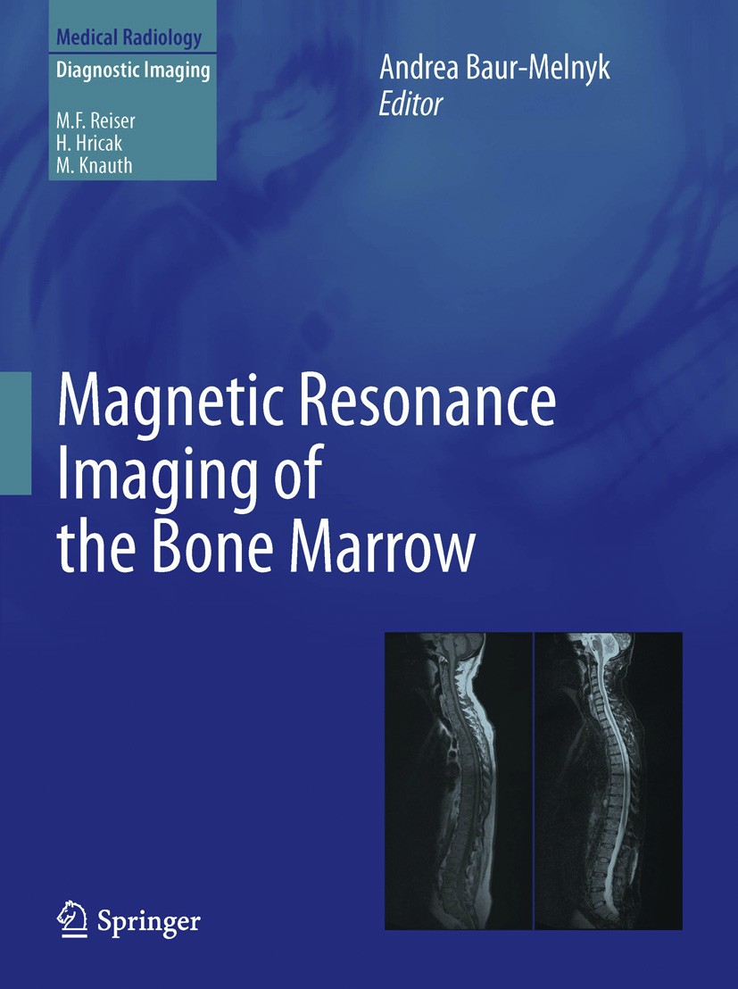 Titlebook: Magnetic Resonance Imaging of the Bone Marrow; Andrea Baur-Melnyk Book 2013 Springer-Verlag Berlin Heidelberg 2013 MRI.bone marrow.bone ma Titlebook: Magnetic Resonance Imaging of the Bone Marrow; Andrea Baur-Melnyk Book 2013 Springer-Verlag Berlin Heidelberg 2013 MRI.bone marrow.bone ma