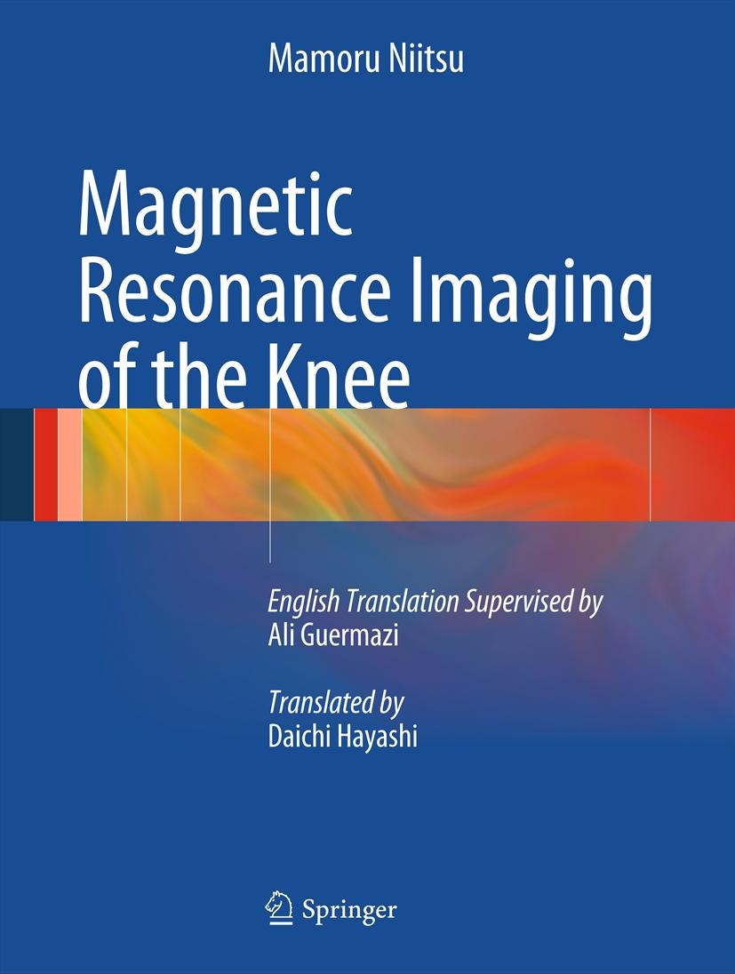 Titlebook: Magnetic Resonance Imaging of the Knee; Mamoru Niitsu Book 2013 Springer-Verlag Berlin Heidelberg 2013 Knee.MRI Titlebook: Magnetic Resonance Imaging of the Knee; Mamoru Niitsu Book 2013 Springer-Verlag Berlin Heidelberg 2013 Knee.MRI