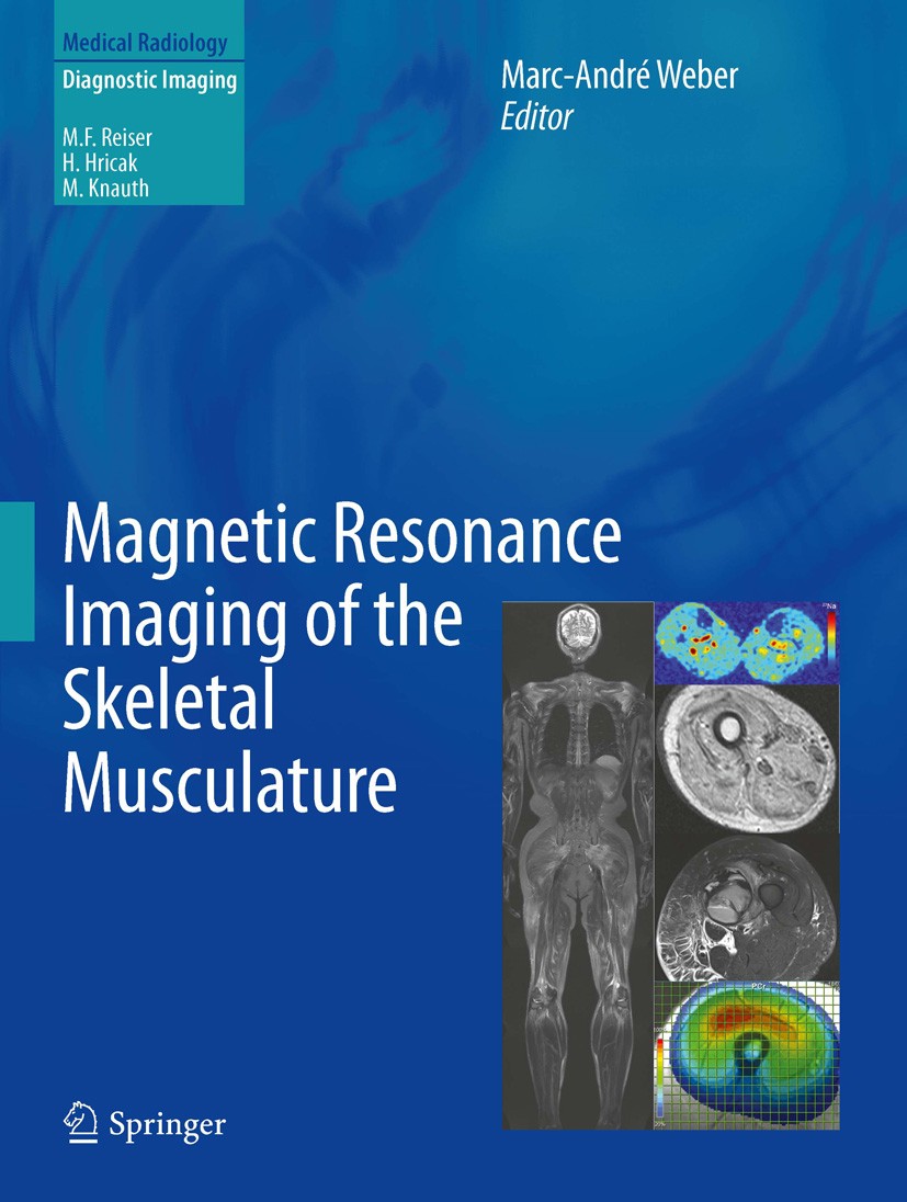 Titlebook: Magnetic Resonance Imaging of the Skeletal Musculature; Marc-André Weber Book 2014 Springer-Verlag Berlin Heidelberg 2014 Magnetic Resonan Titlebook: Magnetic Resonance Imaging of the Skeletal Musculature; Marc-André Weber Book 2014 Springer-Verlag Berlin Heidelberg 2014 Magnetic Resonan