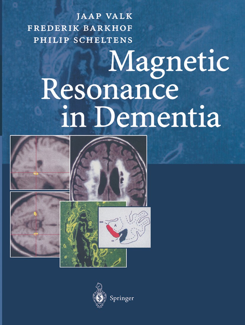 Titlebook: Magnetic Resonance in Dementia; Jaap Valk,Frederik Barkhof,Philip Scheltens Book 2002 Springer-Verlag Berlin Heidelberg 2002 Alzheimer.Dem Titlebook: Magnetic Resonance in Dementia; Jaap Valk,Frederik Barkhof,Philip Scheltens Book 2002 Springer-Verlag Berlin Heidelberg 2002 Alzheimer.Dem