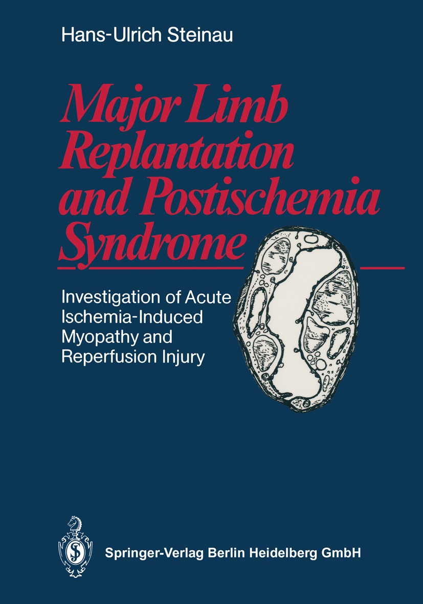 Titlebook: Major Limb Replantation and Postischemia Syndrome; Investigation of Acu Hans-Ulrich Steinau Book 1988 Springer-Verlag Berlin Heidelberg 198 Titlebook: Major Limb Replantation and Postischemia Syndrome; Investigation of Acu Hans-Ulrich Steinau Book 1988 Springer-Verlag Berlin Heidelberg 198