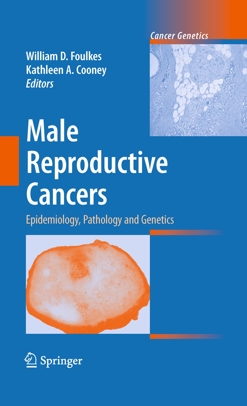 Titlebook: Male Reproductive Cancers; Epidemiology, Pathol William D. Foulkes,Kathleen A. Cooney Book 2010 Springer-Verlag New York 2010 Allele.Gradin Titlebook: Male Reproductive Cancers; Epidemiology, Pathol William D. Foulkes,Kathleen A. Cooney Book 2010 Springer-Verlag New York 2010 Allele.Gradin
