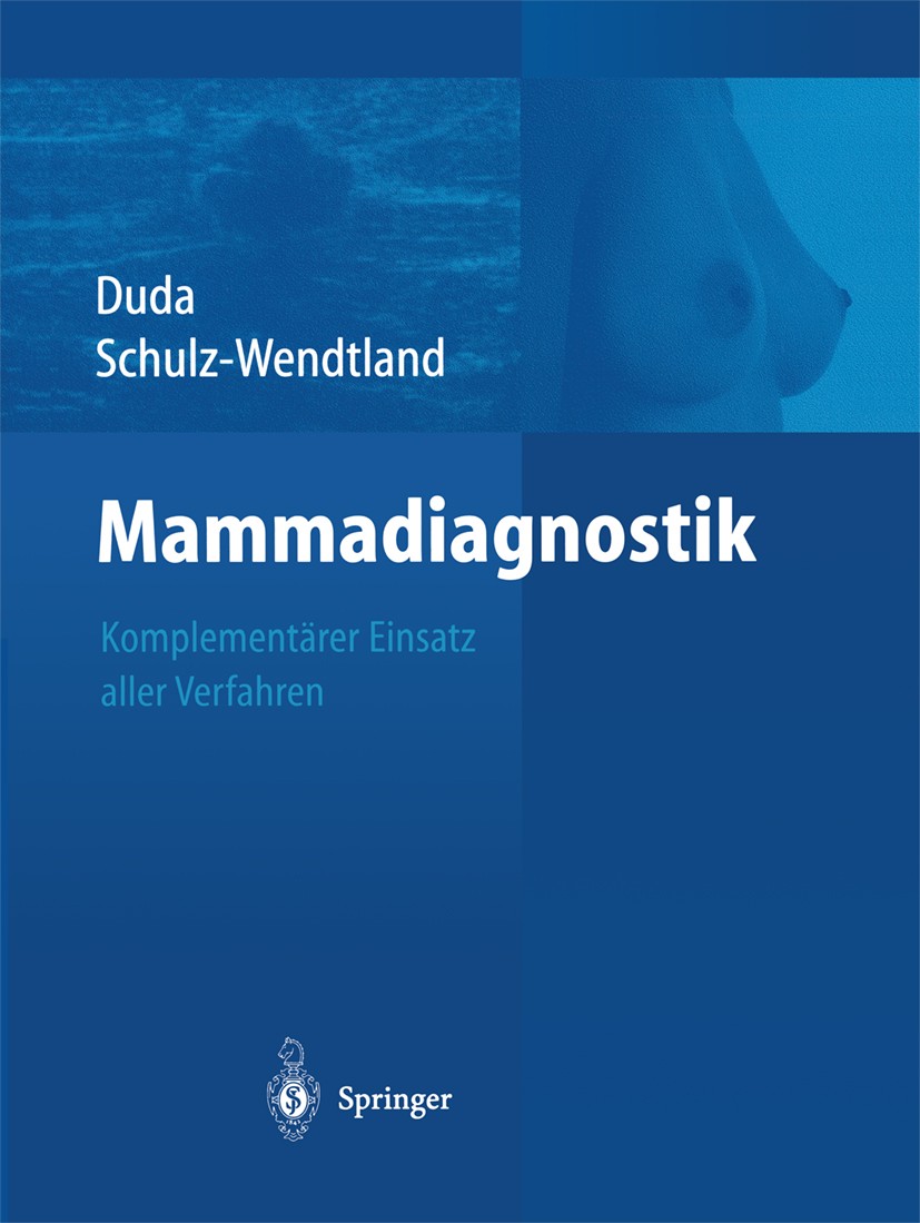 Titlebook: Mammadiagnostik; Komplementärer Einsa Volker F. Duda,Rüdiger Schulz-Wendtland Book 20041st edition Springer-Verlag Berlin Heidelberg 2004 D Titlebook: Mammadiagnostik; Komplementärer Einsa Volker F. Duda,Rüdiger Schulz-Wendtland Book 20041st edition Springer-Verlag Berlin Heidelberg 2004 D