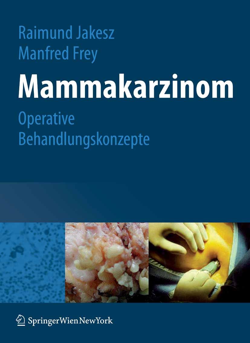 Titlebook: Mammakarzinom; Operative Behandlung Raimund Jakesz,Manfred Frey Book 20071st edition Springer-Verlag Vienna 2007 Brustkrebs.Brustoperation. Titlebook: Mammakarzinom; Operative Behandlung Raimund Jakesz,Manfred Frey Book 20071st edition Springer-Verlag Vienna 2007 Brustkrebs.Brustoperation.