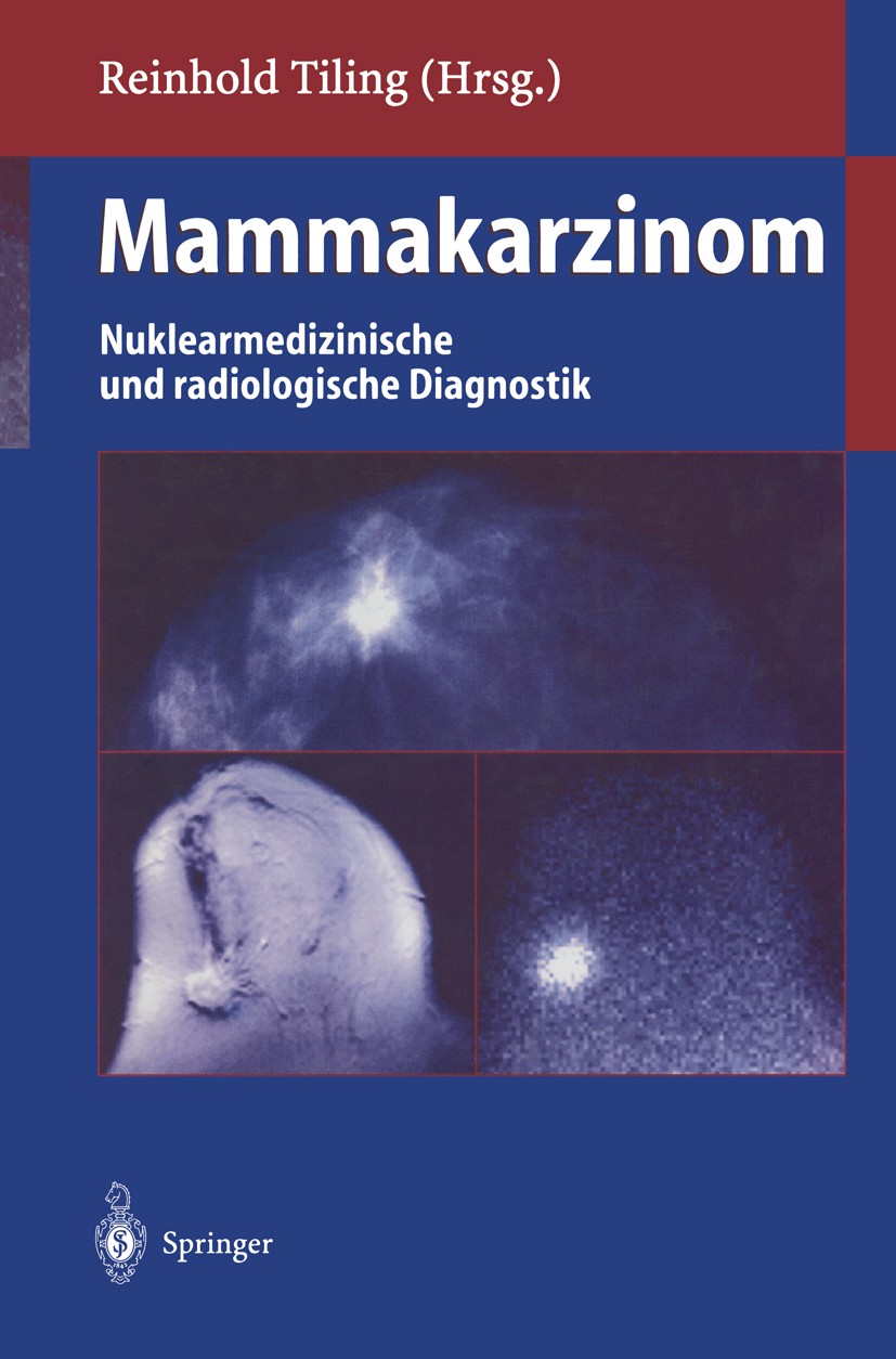 Titlebook: Mammakarzinom; Nuklearmedizinische Reinhold Tiling Book 1998 Springer-Verlag Berlin Heidelberg 1998 Computertomographie.Computertomographi Titlebook: Mammakarzinom; Nuklearmedizinische Reinhold Tiling Book 1998 Springer-Verlag Berlin Heidelberg 1998 Computertomographie.Computertomographi