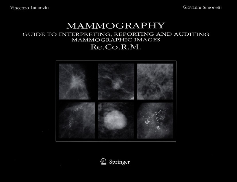 Titlebook: Mammography; Guide to Interpretin Vincenzo Lattanzio,Giovanni Simonetti Book 2005 Springer-Verlag Berlin Heidelberg 2005 Breast Cancer Scre Titlebook: Mammography; Guide to Interpretin Vincenzo Lattanzio,Giovanni Simonetti Book 2005 Springer-Verlag Berlin Heidelberg 2005 Breast Cancer Scre