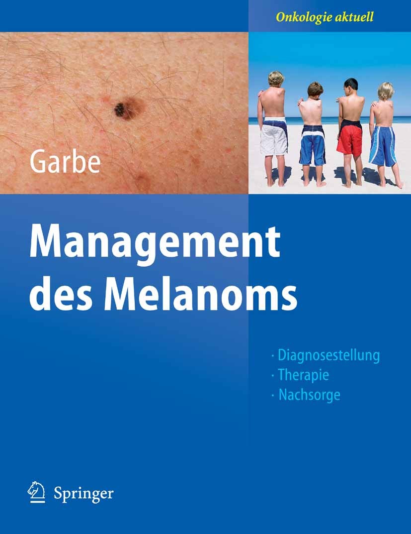 Titlebook: Management des Melanoms; Claus Garbe Book 2006 Springer-Verlag Berlin Heidelberg 2006 Chemotherapie.Dermatologie.Hautkrebs.Immuntherapie.K Titlebook: Management des Melanoms; Claus Garbe Book 2006 Springer-Verlag Berlin Heidelberg 2006 Chemotherapie.Dermatologie.Hautkrebs.Immuntherapie.K