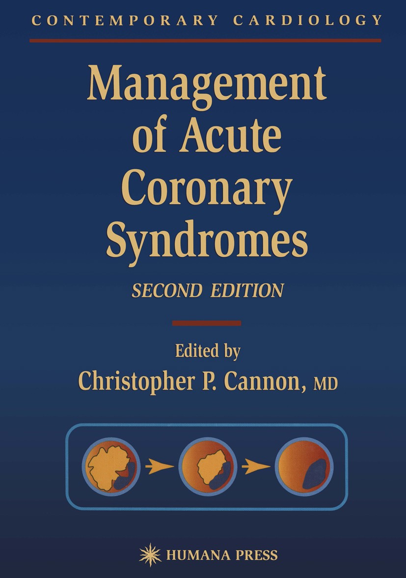 Titlebook: Management of Acute Coronary Syndromes; Christopher P. Cannon (Associate Professor of Medi Book 2003 Springer Science+Business Media New Y Titlebook: Management of Acute Coronary Syndromes; Christopher P. Cannon (Associate Professor of Medi Book 2003 Springer Science+Business Media New Y