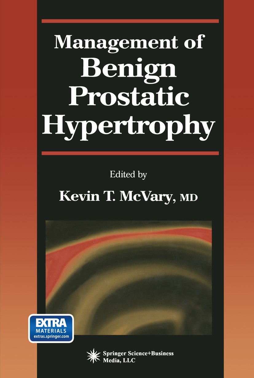 Titlebook: Management of Benign Prostatic Hypertrophy; Kevin T. McVary Book 2004 Springer Science+Business Media New York 2004 laser.pathophysiology. Titlebook: Management of Benign Prostatic Hypertrophy; Kevin T. McVary Book 2004 Springer Science+Business Media New York 2004 laser.pathophysiology.