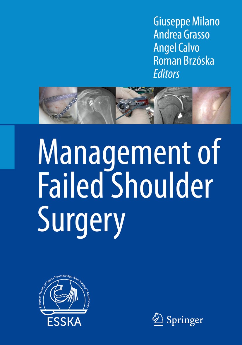 Titlebook: Management of Failed Shoulder Surgery; Giuseppe Milano,Andrea Grasso,Roman Brzóska Book 2018 Springer-Verlag GmbH Germany, part of Springe Titlebook: Management of Failed Shoulder Surgery; Giuseppe Milano,Andrea Grasso,Roman Brzóska Book 2018 Springer-Verlag GmbH Germany, part of Springe