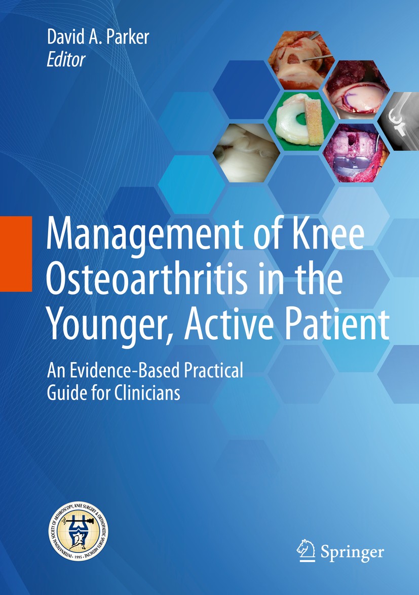 Titlebook: Management of Knee Osteoarthritis in the Younger, Active Patient; An Evidence-Based Pr David Parker Book 2016 Springer-Verlag GmbH Germany, Titlebook: Management of Knee Osteoarthritis in the Younger, Active Patient; An Evidence-Based Pr David Parker Book 2016 Springer-Verlag GmbH Germany,