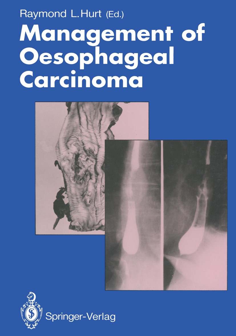 Titlebook: Management of Oesophageal Carcinoma; Raymond L. Hurt (Consultant Thoracic Surgeon) Book 1989 Springer-Verlag Berlin Heidelberg 1989 anatom Titlebook: Management of Oesophageal Carcinoma; Raymond L. Hurt (Consultant Thoracic Surgeon) Book 1989 Springer-Verlag Berlin Heidelberg 1989 anatom