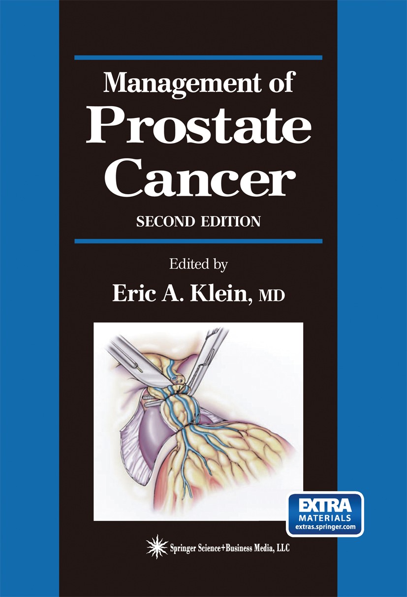 Titlebook: Management of Prostate Cancer; Eric A. Klein (Head) Book 20042nd edition Springer Science+Business Media New York 2004 Brachytherapy.Cance Titlebook: Management of Prostate Cancer; Eric A. Klein (Head) Book 20042nd edition Springer Science+Business Media New York 2004 Brachytherapy.Cance