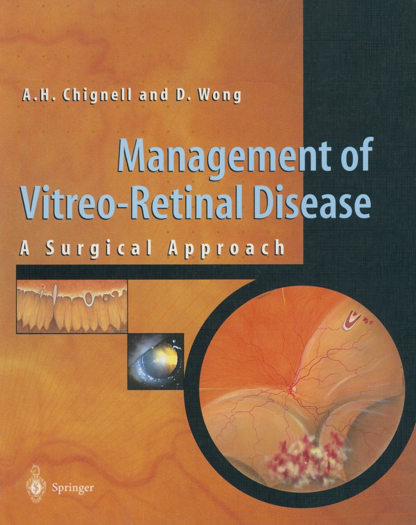 Titlebook: Management of Vitreo-Retinal Disease; A Surgical Approach Anthony H. Chignell,David Wong Book 1999 Springer-Verlag London 1999 eye.pathogen Titlebook: Management of Vitreo-Retinal Disease; A Surgical Approach Anthony H. Chignell,David Wong Book 1999 Springer-Verlag London 1999 eye.pathogen