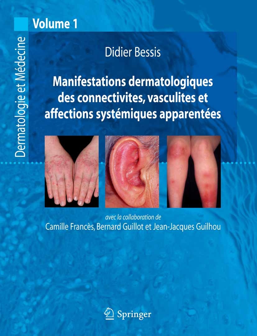 Titlebook: Manifestations dermatologiques des connectivites, vasculites et affections systémiques apparentées; Dermatologie et méde Didier Bessis,Cami Titlebook: Manifestations dermatologiques des connectivites, vasculites et affections systémiques apparentées; Dermatologie et méde Didier Bessis,Cami