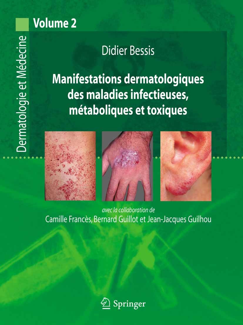 Titlebook: Manifestations dermatologiques des maladies infectieuses, métaboliques et toxiques; Dermatologie et méde Didier Bessis Book 2008Latest edit Titlebook: Manifestations dermatologiques des maladies infectieuses, métaboliques et toxiques; Dermatologie et méde Didier Bessis Book 2008Latest edit