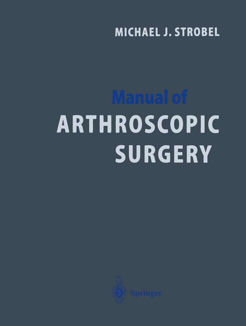 Titlebook: Manual of Arthroscopic Surgery; Michael J. Strobel Book 20021st edition Springer-Verlag Berlin Heidelberg 2002 Arthroscopic.ankle.arthrosc Titlebook: Manual of Arthroscopic Surgery; Michael J. Strobel Book 20021st edition Springer-Verlag Berlin Heidelberg 2002 Arthroscopic.ankle.arthrosc