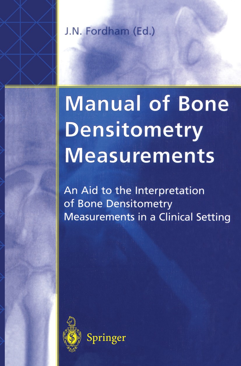 Titlebook: Manual of Bone Densitometry Measurements; An Aid to the Interp John N. Fordham (Consultant Rheumatologist) Book 20001st edition Springer-Ve Titlebook: Manual of Bone Densitometry Measurements; An Aid to the Interp John N. Fordham (Consultant Rheumatologist) Book 20001st edition Springer-Ve