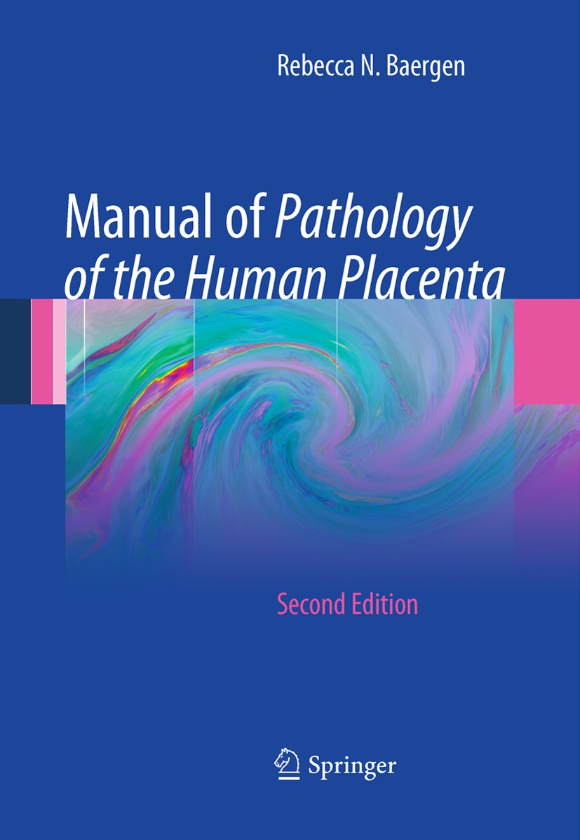 Titlebook: Manual of Pathology of the Human Placenta; Second Edition Rebecca N. Baergen Book 2011Latest edition Springer Science+Business Media, LLC 2 Titlebook: Manual of Pathology of the Human Placenta; Second Edition Rebecca N. Baergen Book 2011Latest edition Springer Science+Business Media, LLC 2