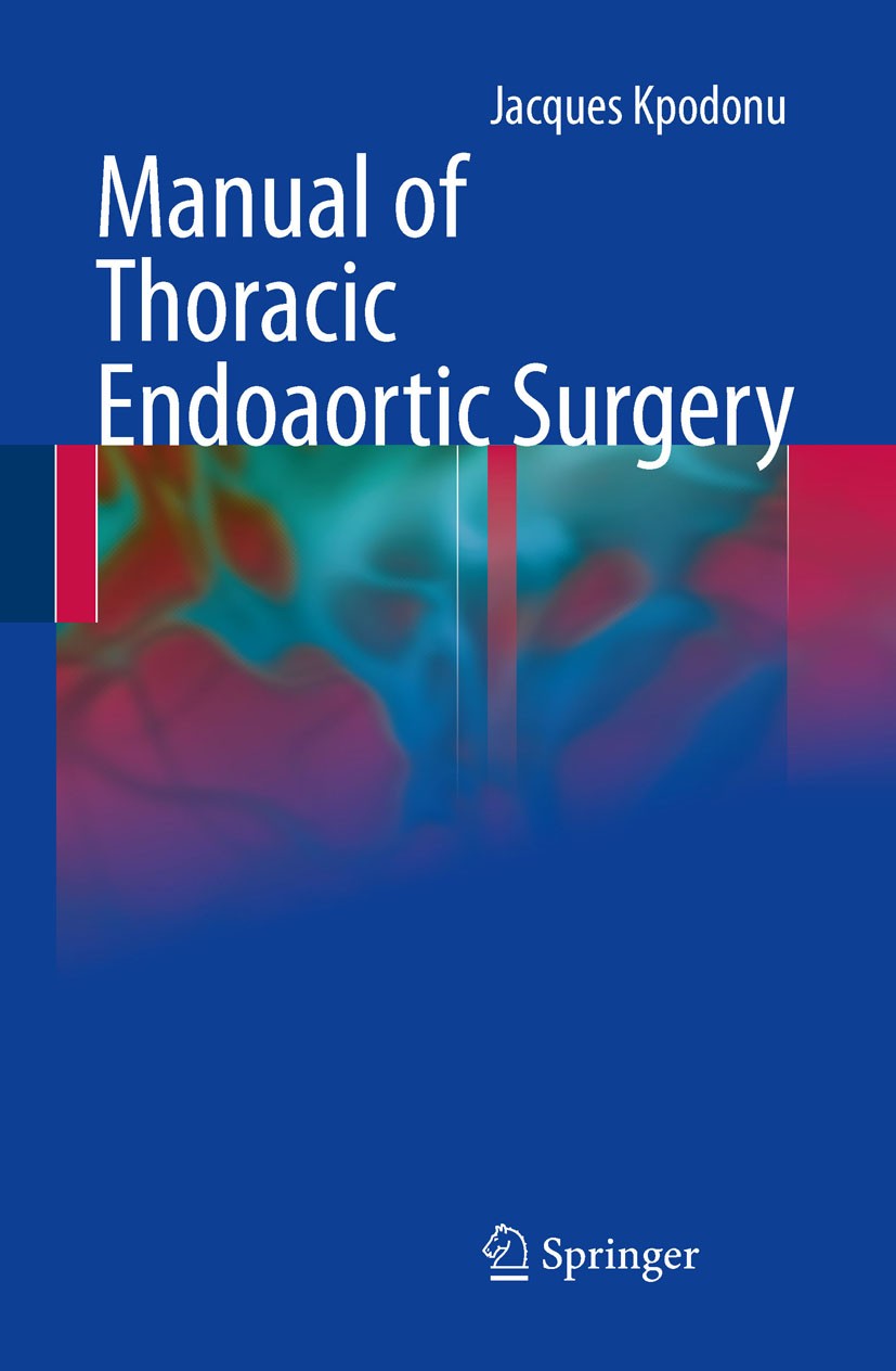 Titlebook: Manual of Thoracic Endoaortic Surgery; Jacques Kpodonu Book 2010 Springer-Verlag London Limited 2010 Stent.anatomy.aneurysm.angiography.ca Titlebook: Manual of Thoracic Endoaortic Surgery; Jacques Kpodonu Book 2010 Springer-Verlag London Limited 2010 Stent.anatomy.aneurysm.angiography.ca