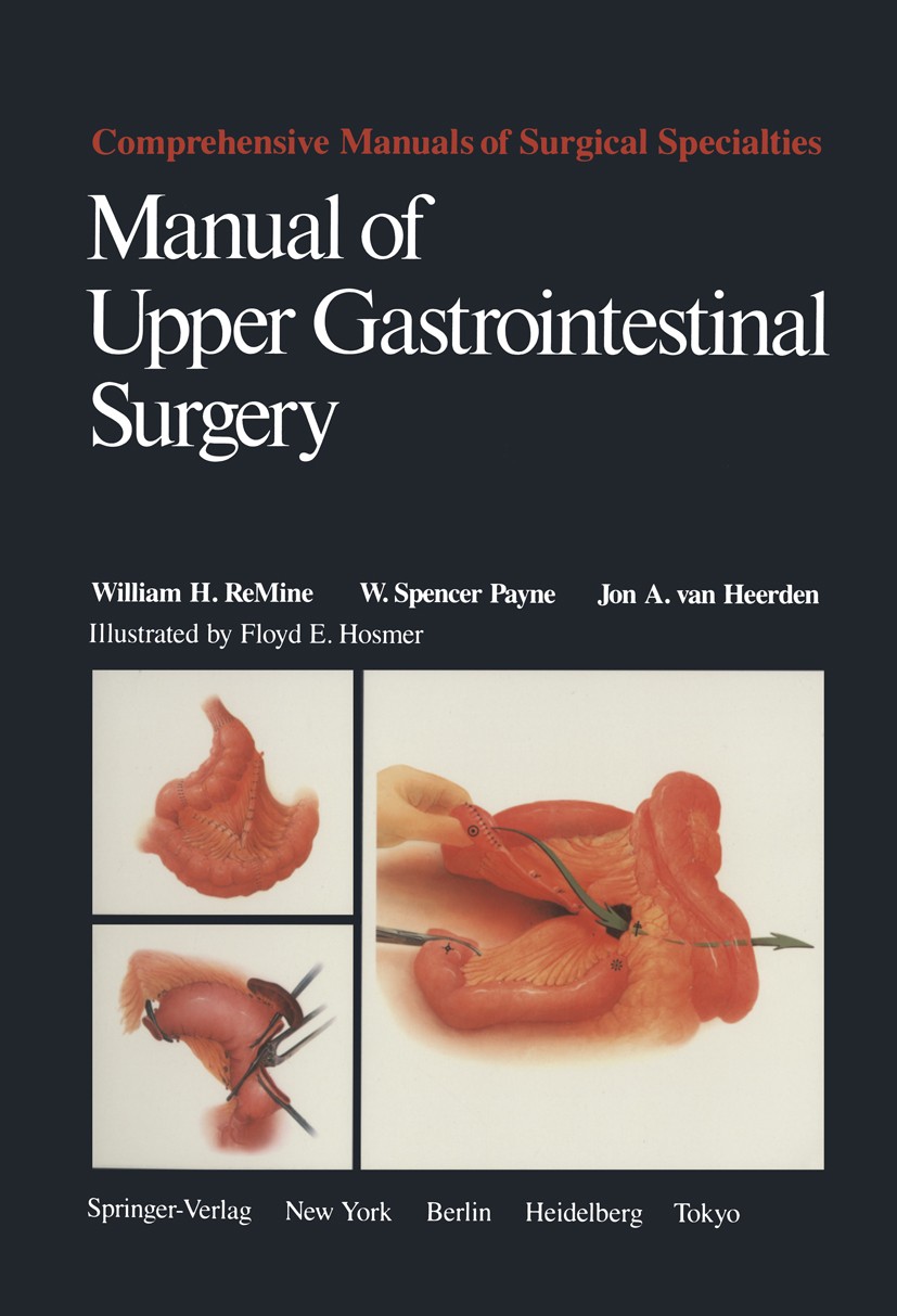 Titlebook: Manual of Upper Gastrointestinal Surgery; William H. ReMine,W. Spencer Payne,Jon A. Heerden Book 1985 Springer-Verlag New York Inc. 1985 G Titlebook: Manual of Upper Gastrointestinal Surgery; William H. ReMine,W. Spencer Payne,Jon A. Heerden Book 1985 Springer-Verlag New York Inc. 1985 G