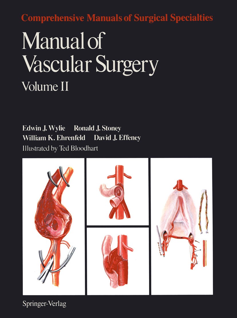 Titlebook: Manual of Vascular Surgery; Edwin J. Wylie,Ronald J. Stoney,David J. Effeney Book 1986 Springer Science+Business Media New York 1986 Bypas Titlebook: Manual of Vascular Surgery; Edwin J. Wylie,Ronald J. Stoney,David J. Effeney Book 1986 Springer Science+Business Media New York 1986 Bypas