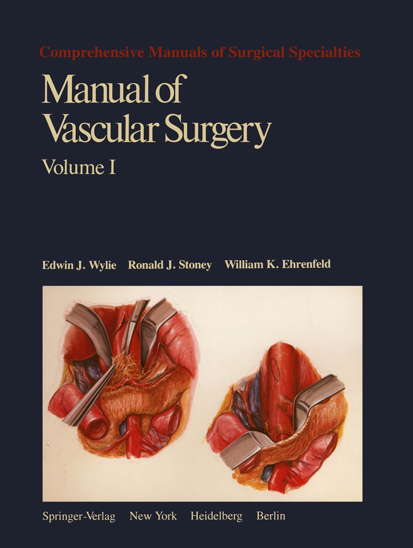 Titlebook: Manual of Vascular Surgery; Edwin J. Wylie,Ronald J. Stoney,William K. Ehrenfe Book 1980 Springer-Verlag New York Inc. 1980 Gefässchirurgi Titlebook: Manual of Vascular Surgery; Edwin J. Wylie,Ronald J. Stoney,William K. Ehrenfe Book 1980 Springer-Verlag New York Inc. 1980 Gefässchirurgi