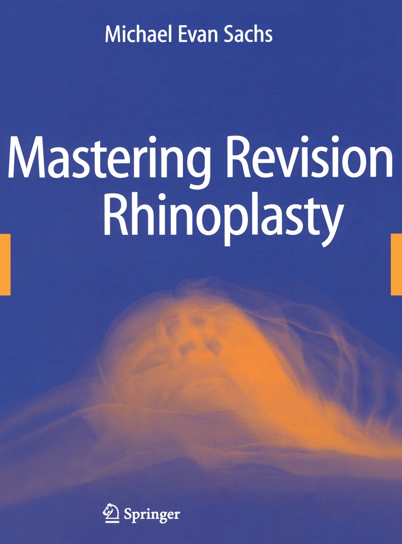 Titlebook: Mastering Revision Rhinoplasty; Michael Evan Sachs Book 2006 Springer-Verlag New York 2006 aesthetics.anatomy.reconstructive surgery.rhino Titlebook: Mastering Revision Rhinoplasty; Michael Evan Sachs Book 2006 Springer-Verlag New York 2006 aesthetics.anatomy.reconstructive surgery.rhino