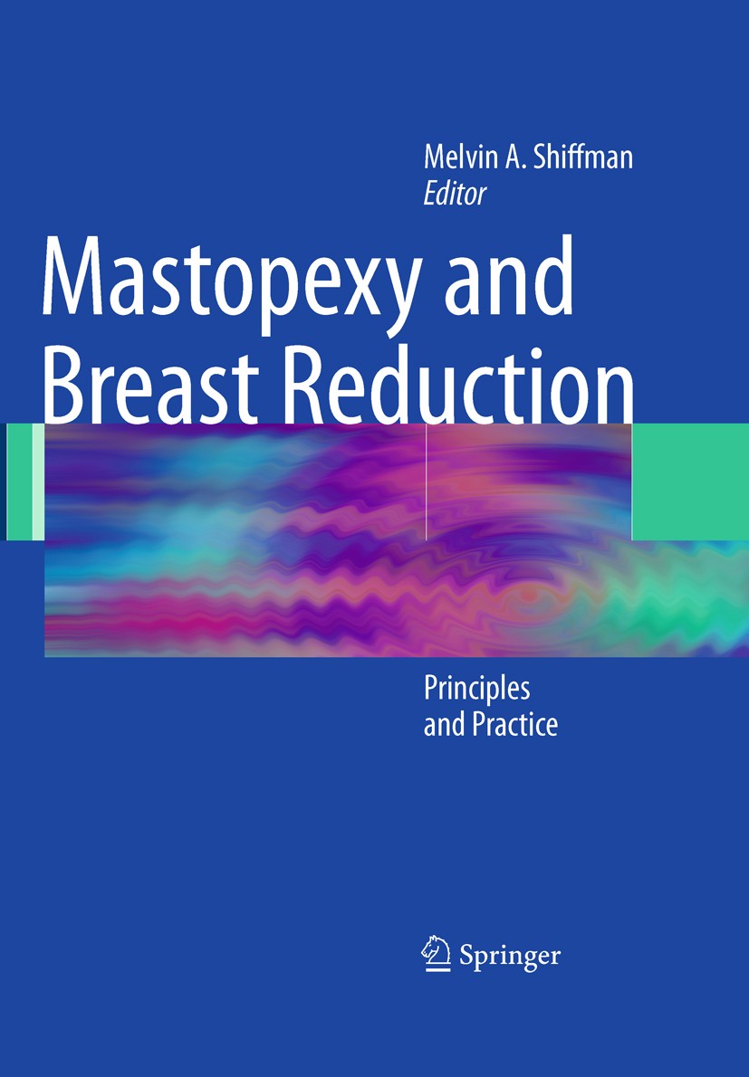 Titlebook: Mastopexy and Breast Reduction; Principles and Pract Melvin A. Shiffman Book 2009 Springer-Verlag Berlin Heidelberg 2009 Laser.Surgery.anat Titlebook: Mastopexy and Breast Reduction; Principles and Pract Melvin A. Shiffman Book 2009 Springer-Verlag Berlin Heidelberg 2009 Laser.Surgery.anat