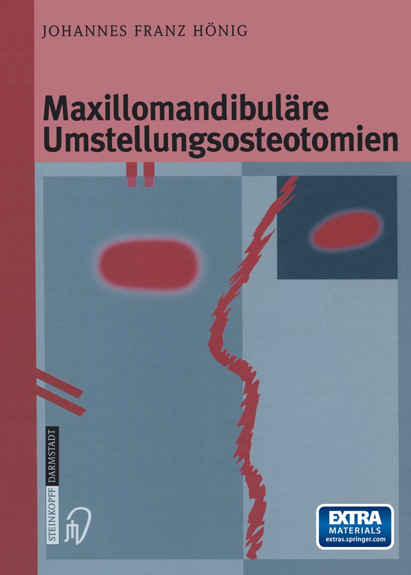 Titlebook: Maxillomandibuläre Umstellungsosteotomien; Johannes Franz Hönig Book 2002 Springer-Verlag Berlin Heidelberg 2002 Kiefer-Gesichtsmißbildung Titlebook: Maxillomandibuläre Umstellungsosteotomien; Johannes Franz Hönig Book 2002 Springer-Verlag Berlin Heidelberg 2002 Kiefer-Gesichtsmißbildung