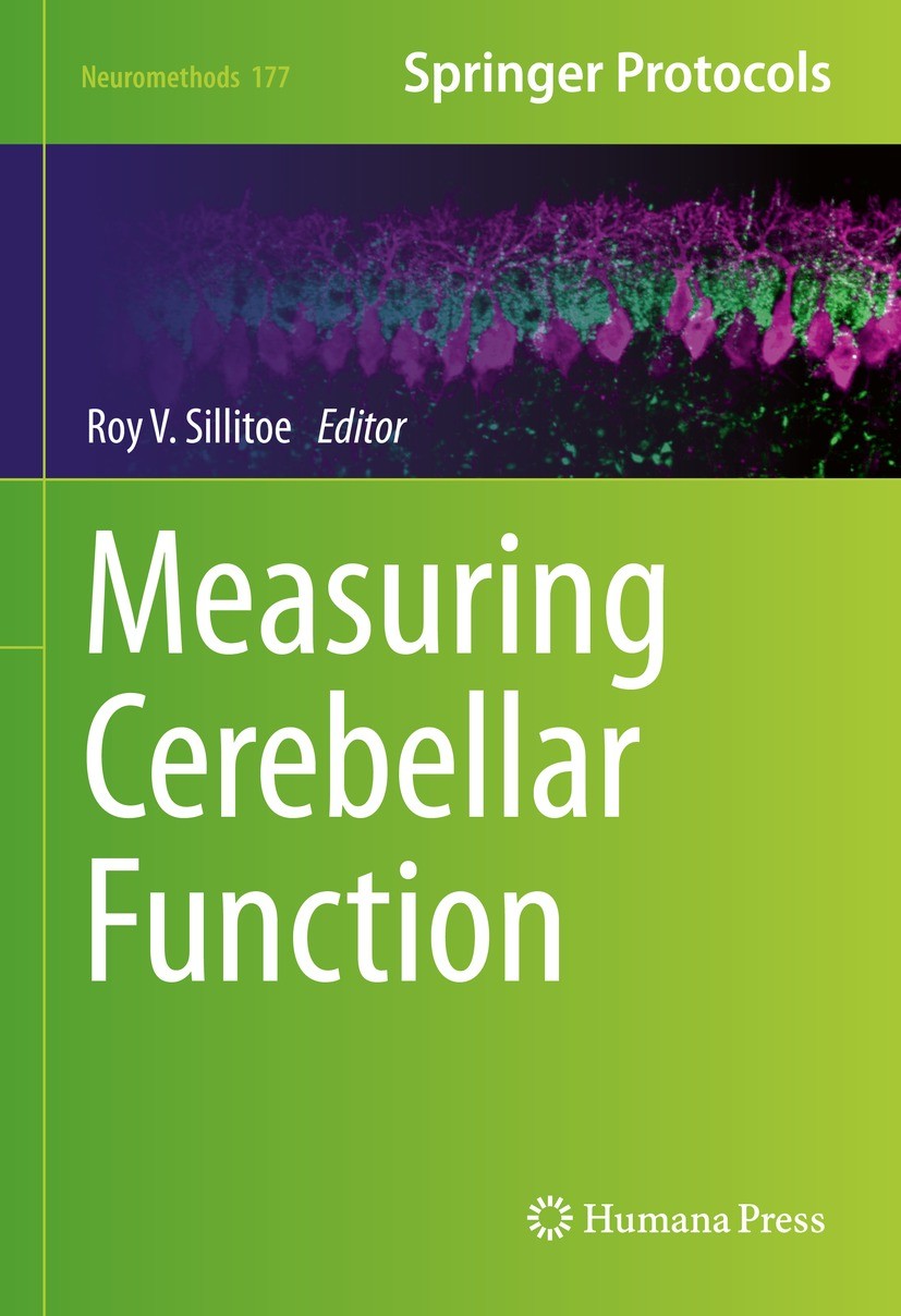 Titlebook: Measuring Cerebellar Function; Roy V. Sillitoe Book 2022 Springer Science+Business Media, LLC, part of Springer Nature 2022 DREADDS.optoge Titlebook: Measuring Cerebellar Function; Roy V. Sillitoe Book 2022 Springer Science+Business Media, LLC, part of Springer Nature 2022 DREADDS.optoge