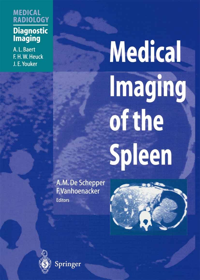 Titlebook: Medical Imaging of the Spleen; Arthur M. Schepper (Professor),Filip Vanhoenacker Book 2000 Springer-Verlag Berlin Heidelberg 2000 CT.Milz. Titlebook: Medical Imaging of the Spleen; Arthur M. Schepper (Professor),Filip Vanhoenacker Book 2000 Springer-Verlag Berlin Heidelberg 2000 CT.Milz.