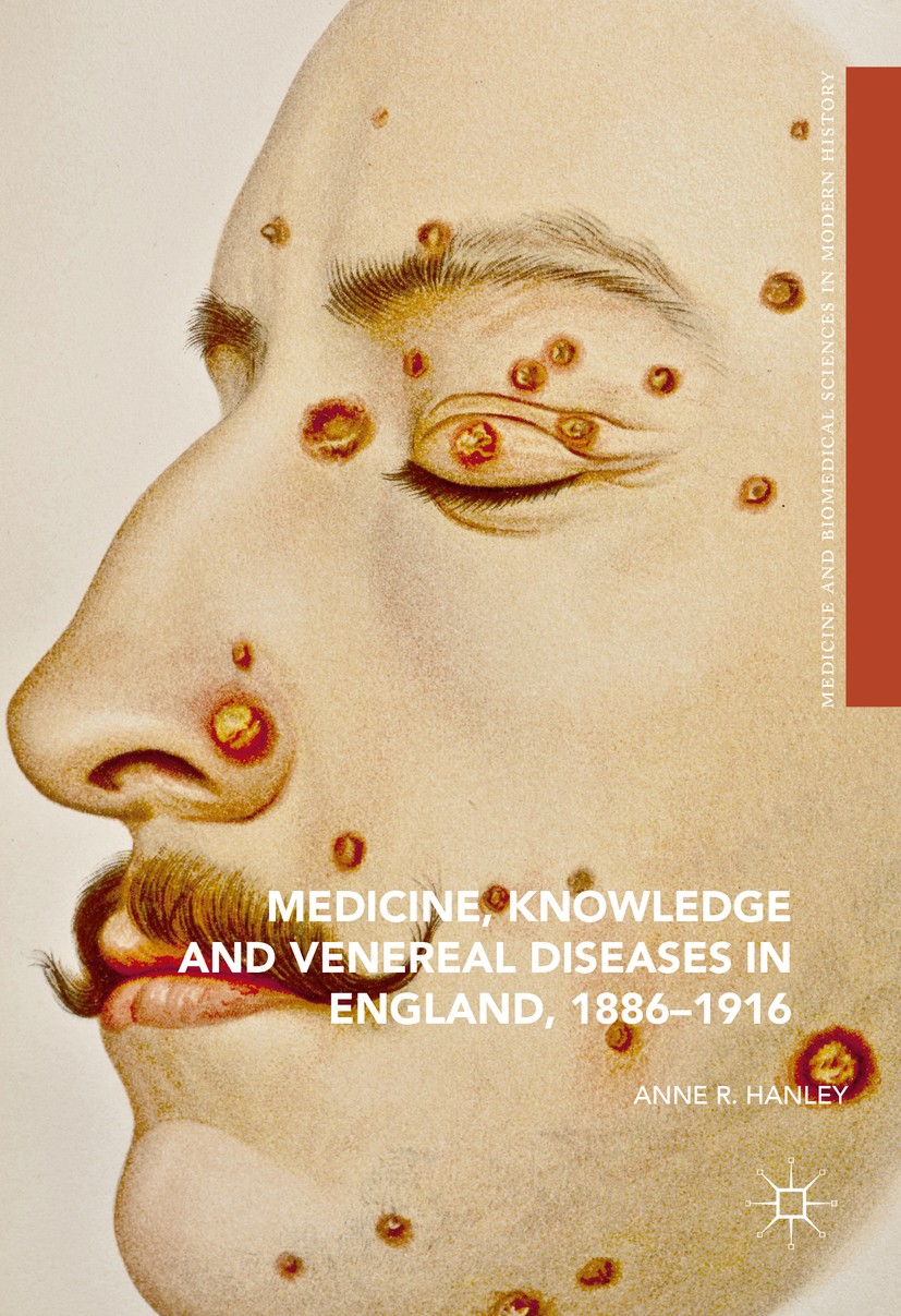 Titlebook: Medicine, Knowledge and Venereal Diseases in England, 1886-1916; Anne R. Hanley Book 2017 The Editor(s) (if applicable) and The Author(s) Titlebook: Medicine, Knowledge and Venereal Diseases in England, 1886-1916; Anne R. Hanley Book 2017 The Editor(s) (if applicable) and The Author(s)