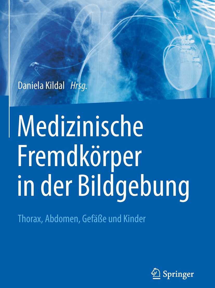 Titlebook: Medizinische Fremdkörper in der Bildgebung; Thorax, Abdomen, Gef Daniela Kildal Book 2016 Springer-Verlag Berlin Heidelberg 2016 Fremdkörpe Titlebook: Medizinische Fremdkörper in der Bildgebung; Thorax, Abdomen, Gef Daniela Kildal Book 2016 Springer-Verlag Berlin Heidelberg 2016 Fremdkörpe