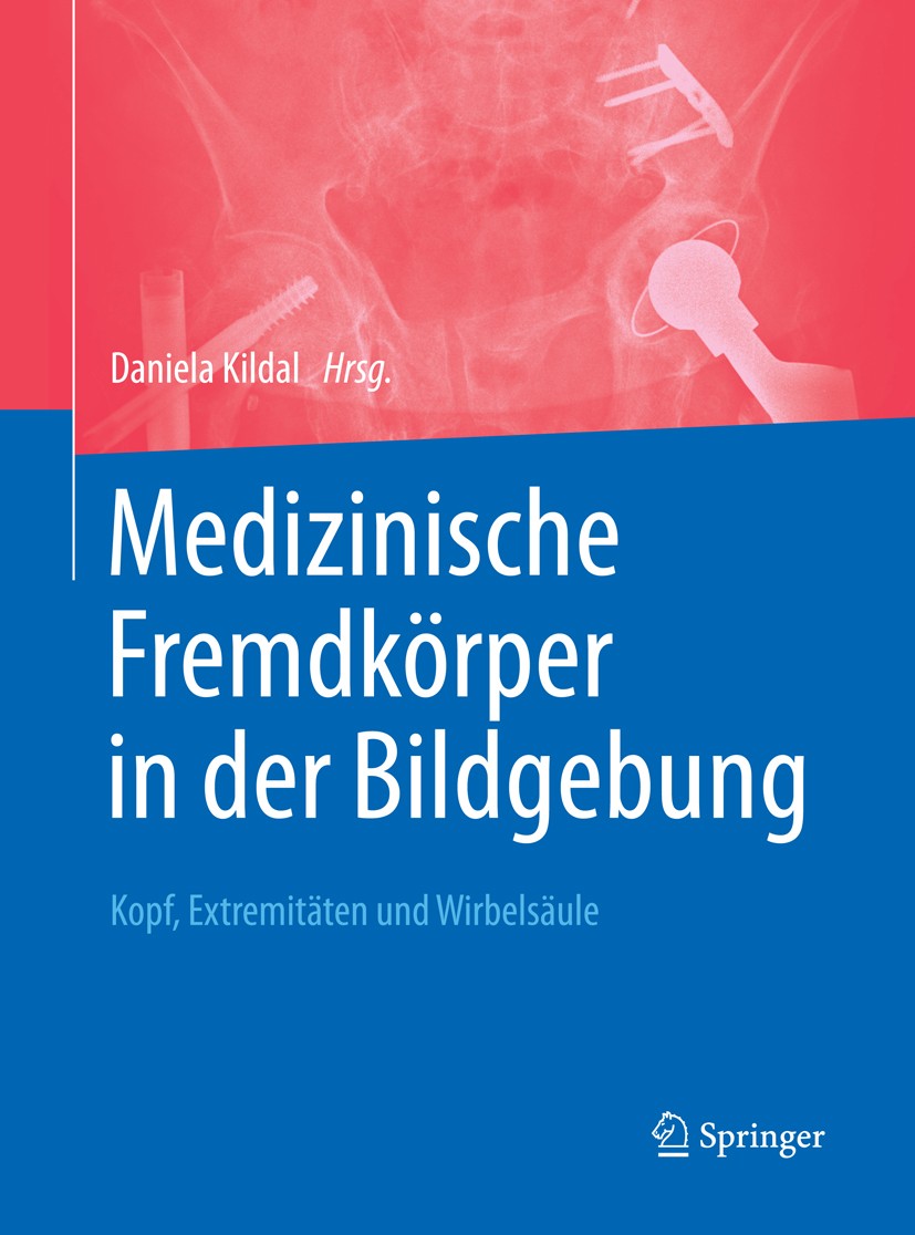 Titlebook: Medizinische Fremdkörper in der Bildgebung; Kopf, Extremitäten u Daniela Kildal Book 2017 © Springer-Verlag GmbH Deutschland 2017 Fremdkörp Titlebook: Medizinische Fremdkörper in der Bildgebung; Kopf, Extremitäten u Daniela Kildal Book 2017 © Springer-Verlag GmbH Deutschland 2017 Fremdkörp