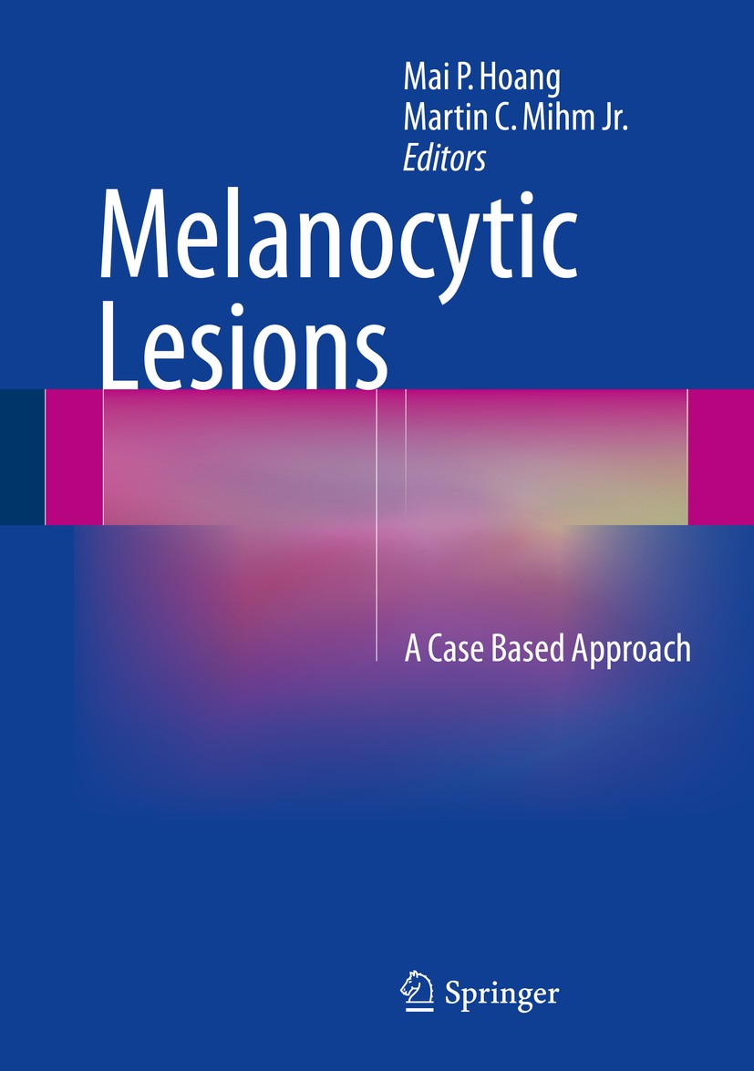 Titlebook: Melanocytic Lesions; A Case Based Approac Mai P. Hoang,Martin C. Mihm Jr. Book 2014 Springer Science+Business Media New York 2014 dermal me Titlebook: Melanocytic Lesions; A Case Based Approac Mai P. Hoang,Martin C. Mihm Jr. Book 2014 Springer Science+Business Media New York 2014 dermal me