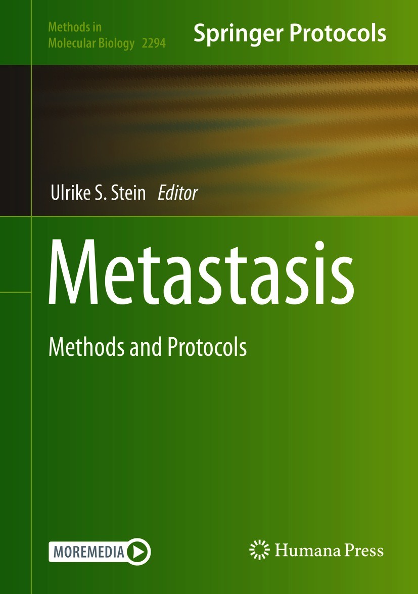 Titlebook: Metastasis; Methods and Protocol Ulrike S. Stein Book 2021 Springer Science+Business Media, LLC, part of Springer Nature 2021 NCI60 tumor c Titlebook: Metastasis; Methods and Protocol Ulrike S. Stein Book 2021 Springer Science+Business Media, LLC, part of Springer Nature 2021 NCI60 tumor c