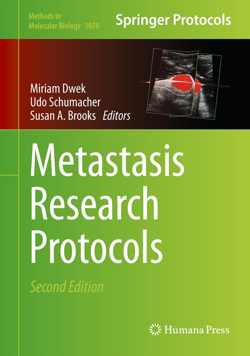 Titlebook: Metastasis Research Protocols; Miriam Dwek,Udo Schumacher,Susan A. Brooks Book 2014Latest edition Springer Science+Business Media, New Yor Titlebook: Metastasis Research Protocols; Miriam Dwek,Udo Schumacher,Susan A. Brooks Book 2014Latest edition Springer Science+Business Media, New Yor