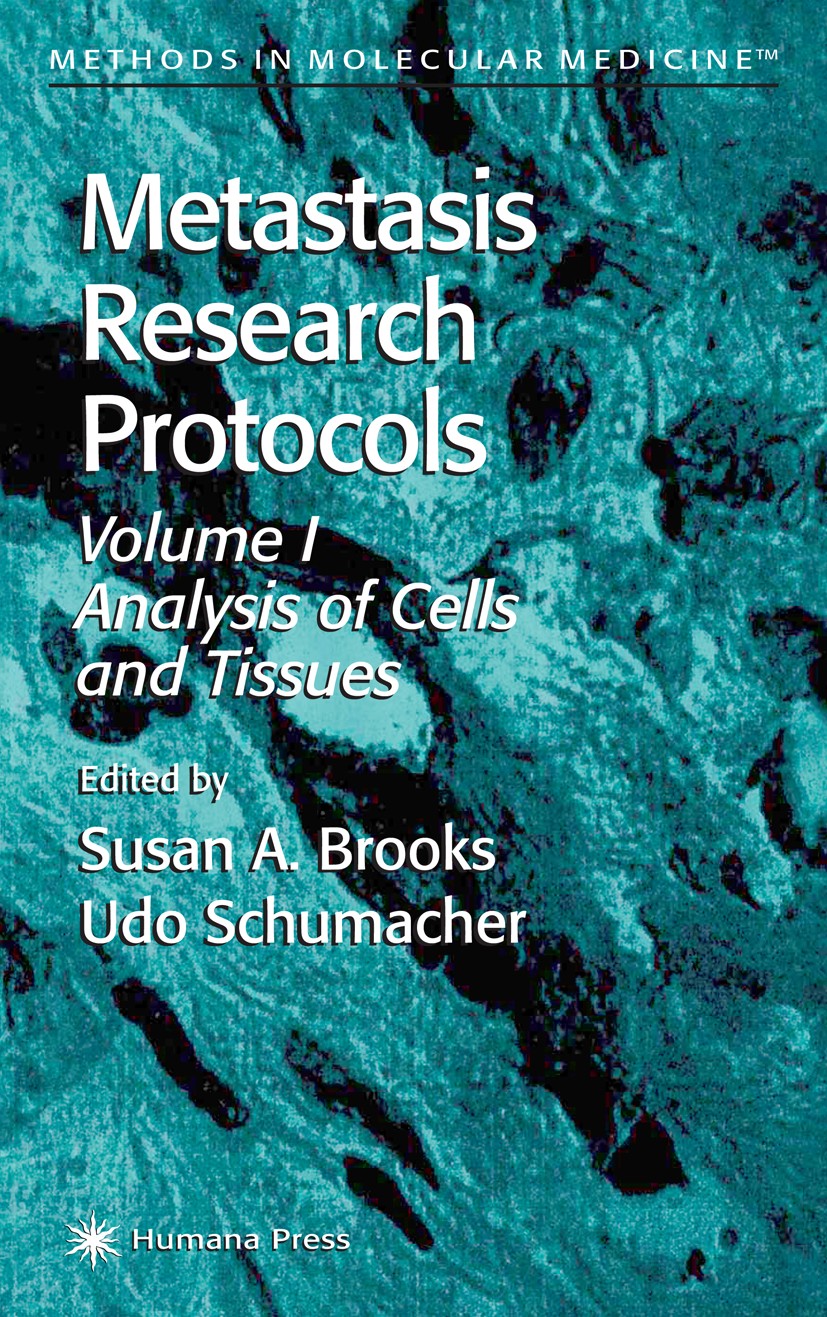 Titlebook: Metastasis Research Protocols; Susan A. Brooks,Udo Schumacher Book 20011st edition Humana Press 2001 Grading.angiogenesis.cells.migration. Titlebook: Metastasis Research Protocols; Susan A. Brooks,Udo Schumacher Book 20011st edition Humana Press 2001 Grading.angiogenesis.cells.migration.