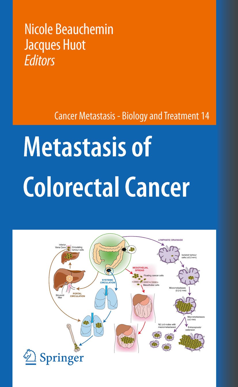 Titlebook: Metastasis of Colorectal Cancer; Nicole Beauchemin,Jacques Huot Book 2010 Springer Science+Business Media B.V. 2010 Metastasis.Staging.ang Titlebook: Metastasis of Colorectal Cancer; Nicole Beauchemin,Jacques Huot Book 2010 Springer Science+Business Media B.V. 2010 Metastasis.Staging.ang