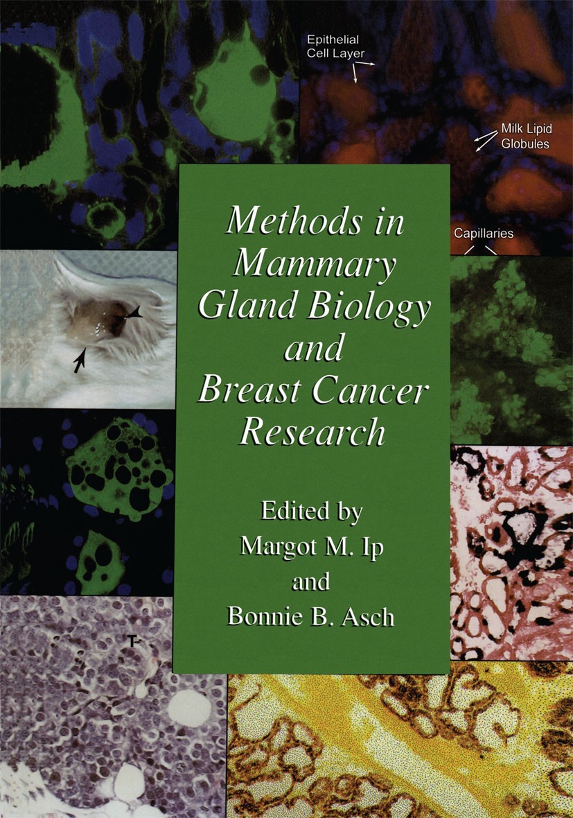 Titlebook: Methods in Mammary Gland Biology and Breast Cancer Research; Margot M. Ip,Bonnie B. Asch Book 2000 Springer Science+Business Media New Yor Titlebook: Methods in Mammary Gland Biology and Breast Cancer Research; Margot M. Ip,Bonnie B. Asch Book 2000 Springer Science+Business Media New Yor