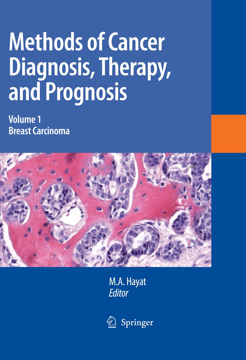 Titlebook: Methods of Cancer Diagnosis, Therapy and Prognosis; Breast Carcinoma M. A. Hayat Book 2008 Springer Science+Business Media B.V. 2008 BRCA.T Titlebook: Methods of Cancer Diagnosis, Therapy and Prognosis; Breast Carcinoma M. A. Hayat Book 2008 Springer Science+Business Media B.V. 2008 BRCA.T