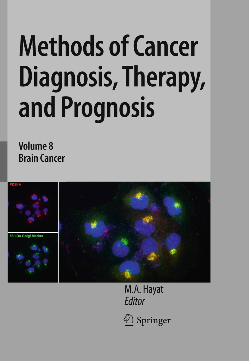 Titlebook: Methods of Cancer Diagnosis, Therapy, and Prognosis; Brain Cancer M. A. Hayat Book 2011 Springer Science+Business Media B.V. 2011 Cancer Me Titlebook: Methods of Cancer Diagnosis, Therapy, and Prognosis; Brain Cancer M. A. Hayat Book 2011 Springer Science+Business Media B.V. 2011 Cancer Me